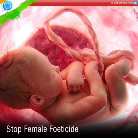 Female foeticide 